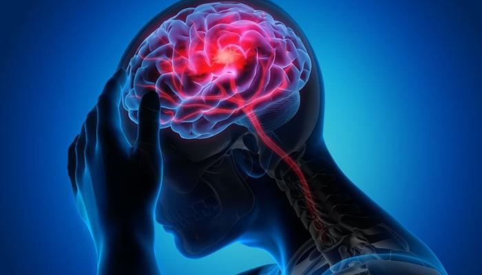 Nöroloji uzmanından inmeye karşı uyarı: "Erken müdahale felci önler"